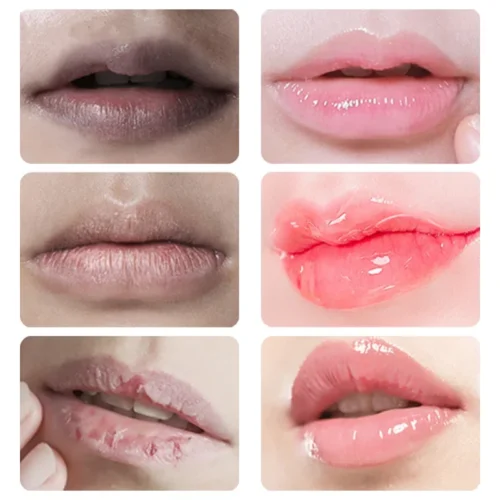 Bálsamo labial Lightening Melanin Mask, Gloss Oil, Esfoliante, Hidratante Limpo, Maquiagem, Beleza, Produtos de Saúde, Novo - Imagem 2